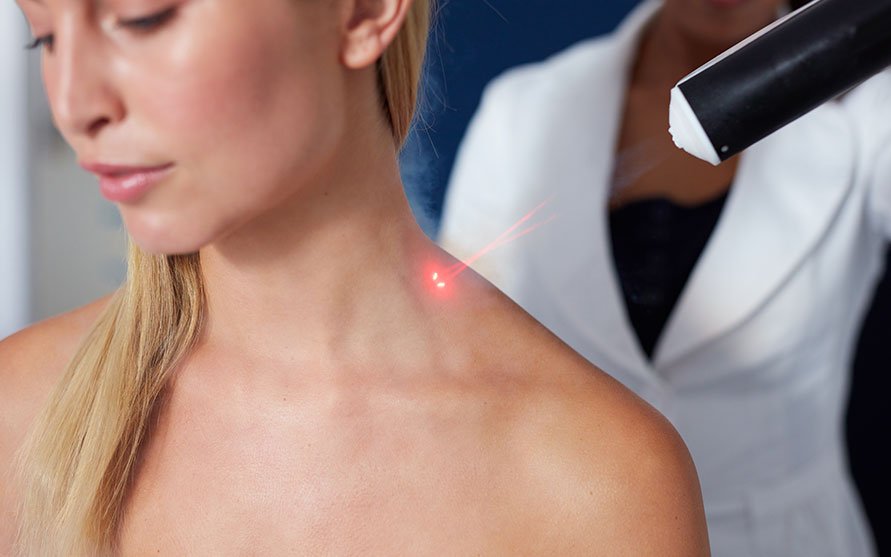 high intensity laser therapy